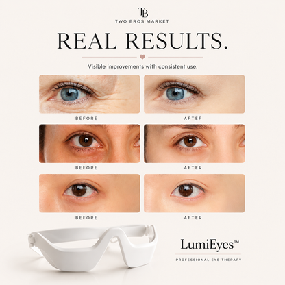 Professional Eye Therapy / LumiEyes™ 3D