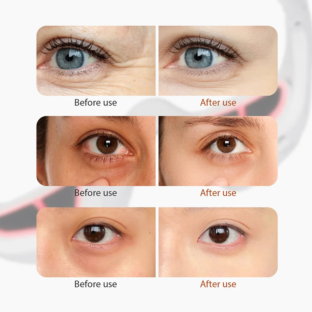Professional Eye Therapy / LumiEyes™ 3D